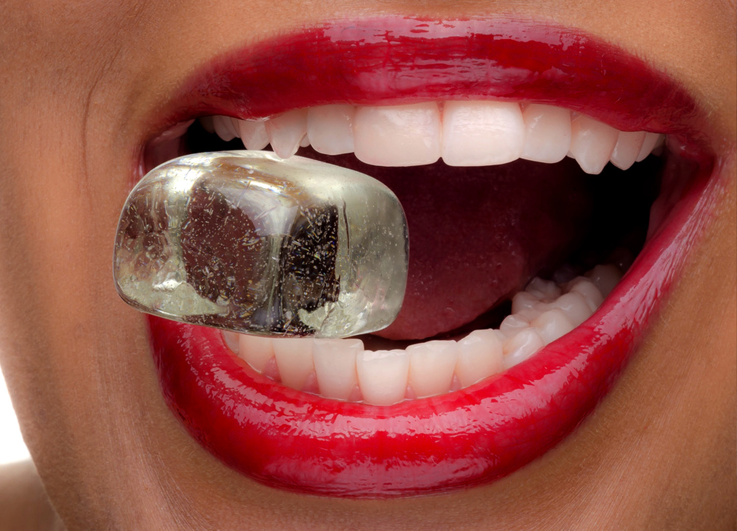 ipersensibilita-dentale