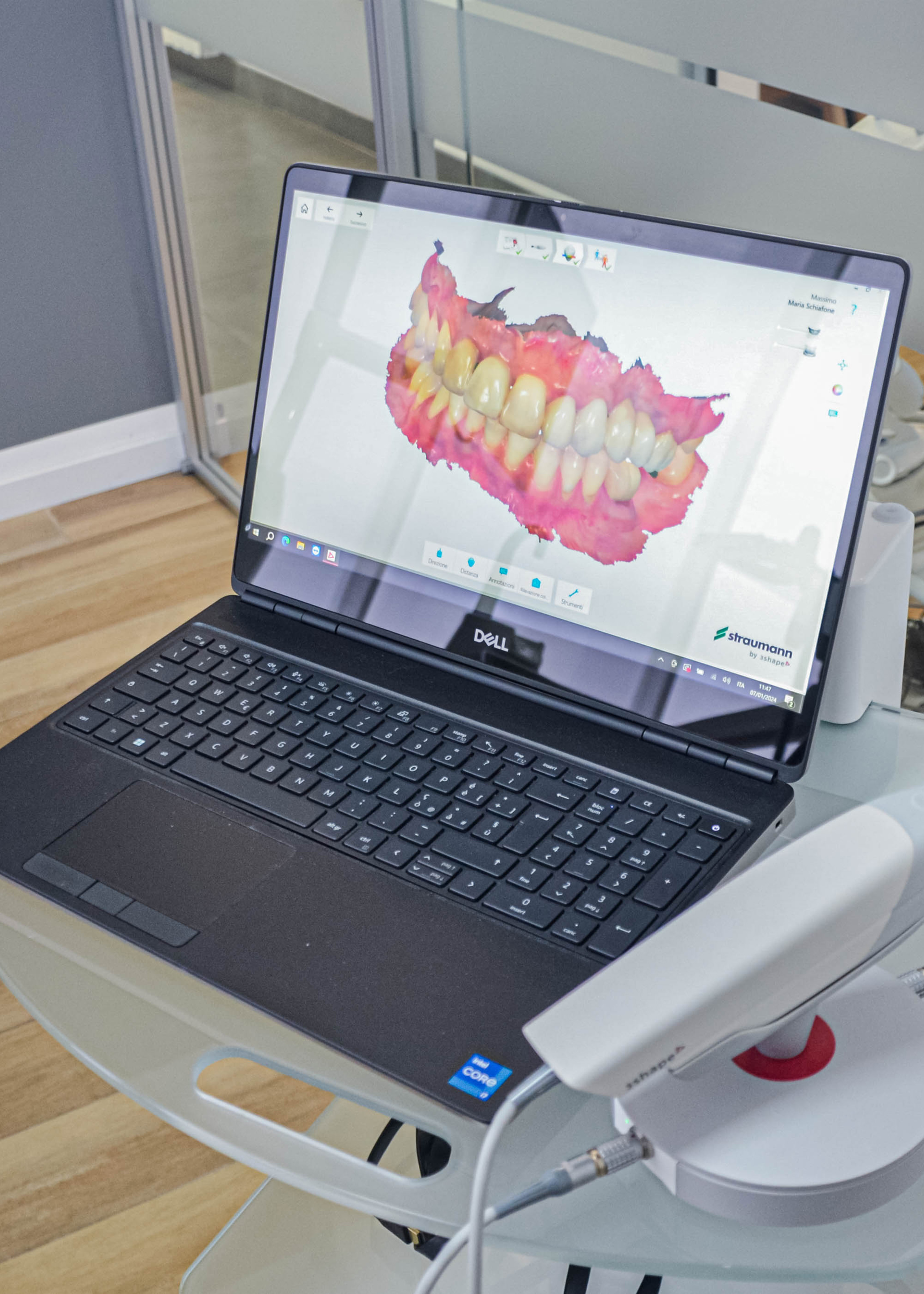 faccette dentali torino