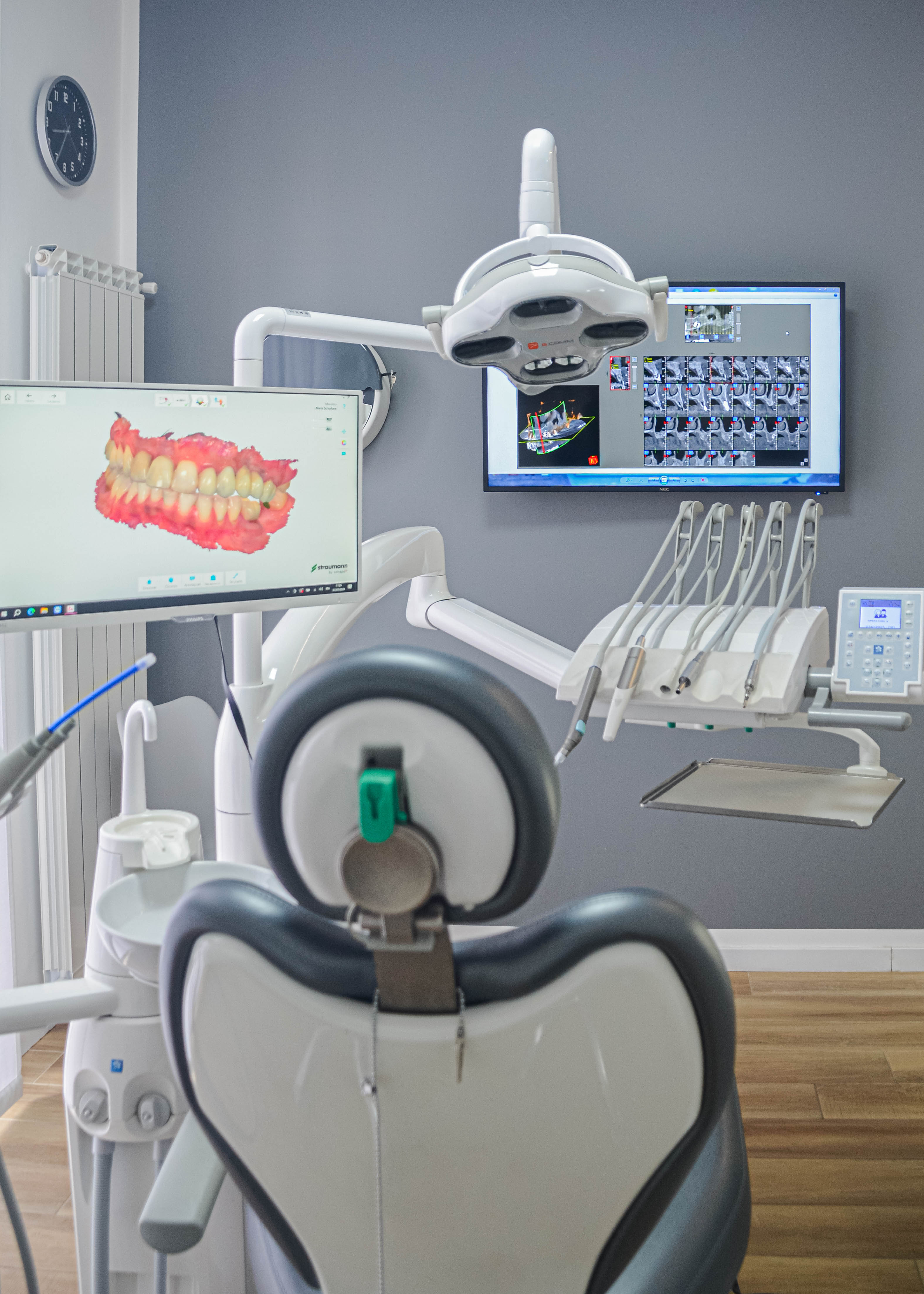 Impianto dentale torino